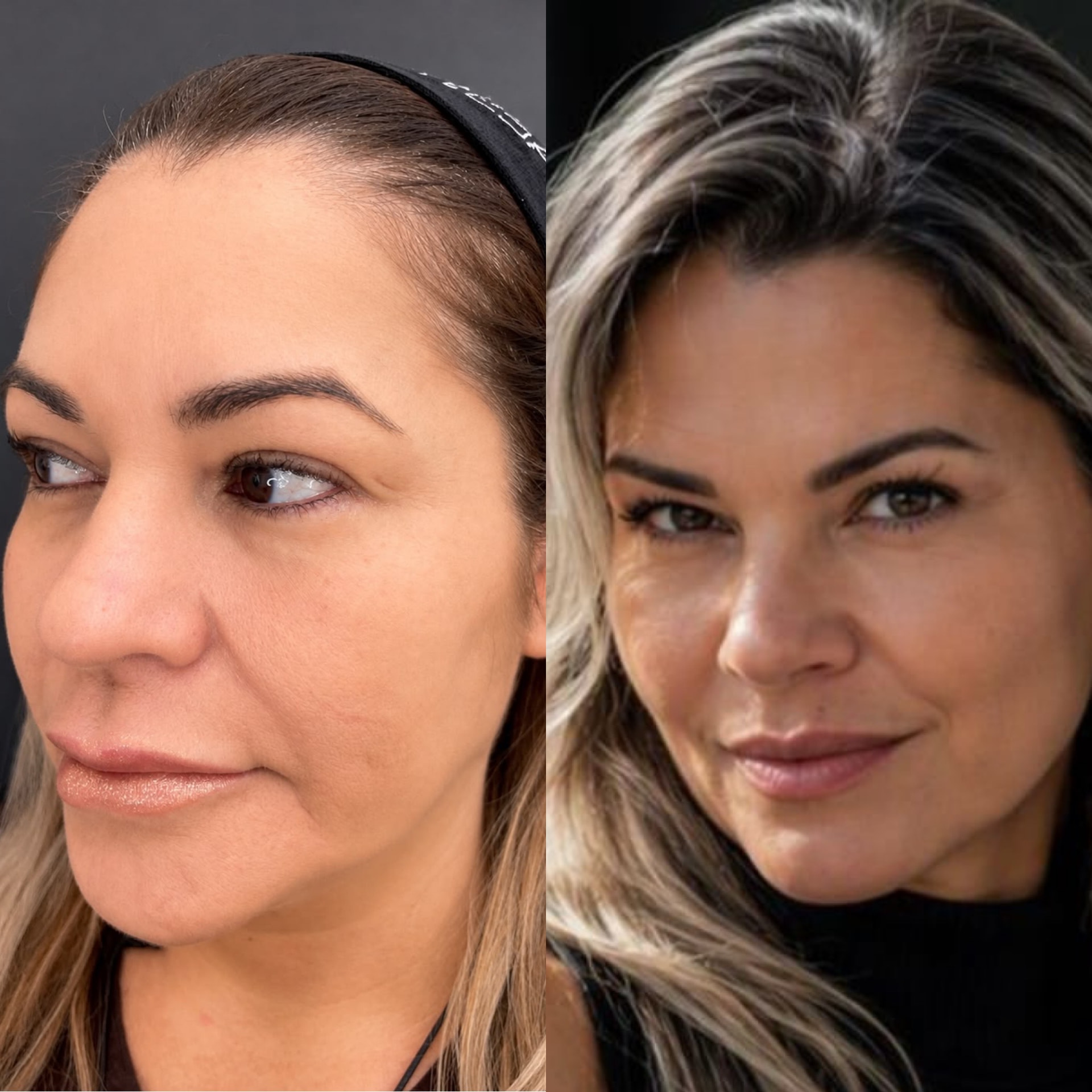 Transformação facial · antes e depois